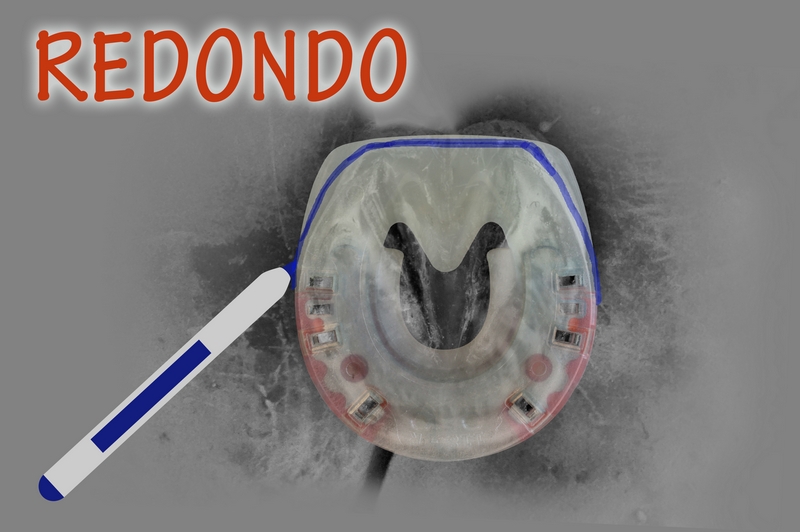 adaptación de una herradura compuesta a la forma del casco delantero