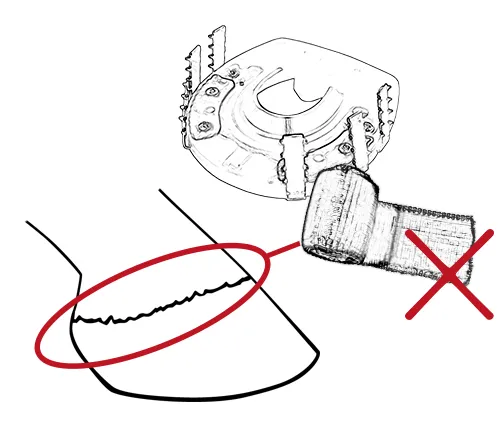 Le bandage « cast » ne doit pas recouvrir le bord coronal du sabot.